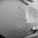 صورة توضح أسباب وعلاج الحمو نيل
