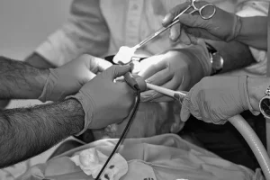 جراحة الصدر التجميلية