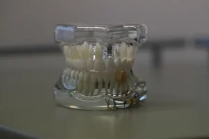 صورة توضح اسباب و علاج بياض اللثة