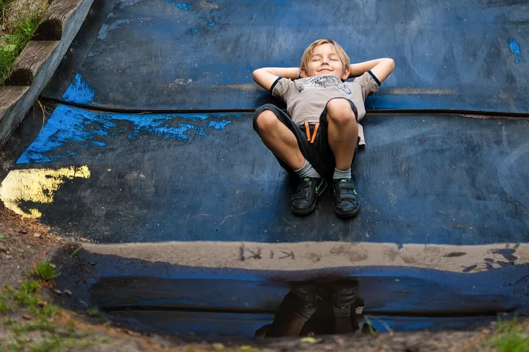 صورة توضح نقص الصفائح الدموية عند الأطفال