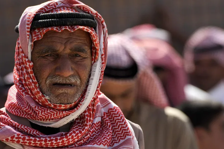 علاج التجاعيد حول العينين