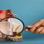احسن علاج للبواسير الملتهبة