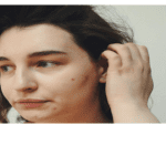 متى تظهر حبوب الحمل في الوجه