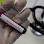متى يتم اجراء اختبار TB