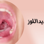 شكل صديد اللوز بالصور