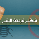 شكل قرصة البق بالصور