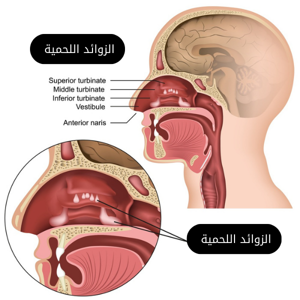لحمية الأنف