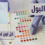 الوان البول: كل لون له دلالات يعنيها