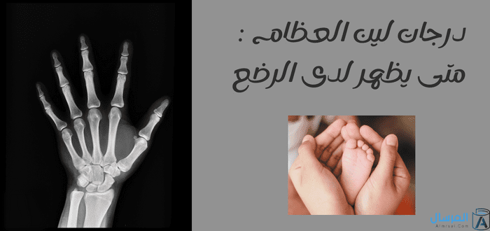 درجات لين العظام متى يظهر لدى الرضع