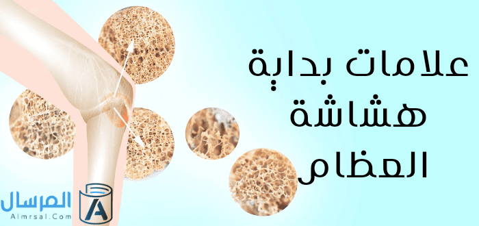 علامات بداية هشاشة العظام
