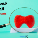 قصور الغدة الدرقية علاماتها .. درجاتها