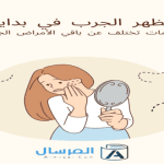 مظهر الجرب في بدايته له علامات تختلف عن باقي الأمراض الجلدية