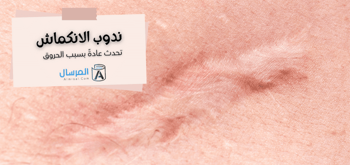 أنواع الندبات