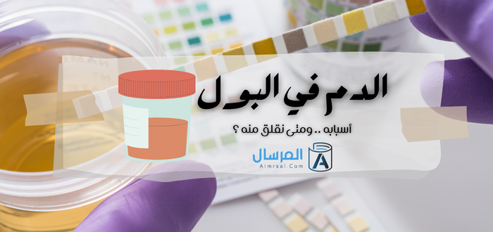 الدم في البول أسبابه .. ومتى نقلق منه ؟
