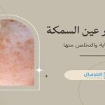 سبب ظهور عين السمكة طرق الوقاية والتخلص منها