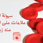 سيولة الدم علامات على الجسم تحدث عند زيادتها