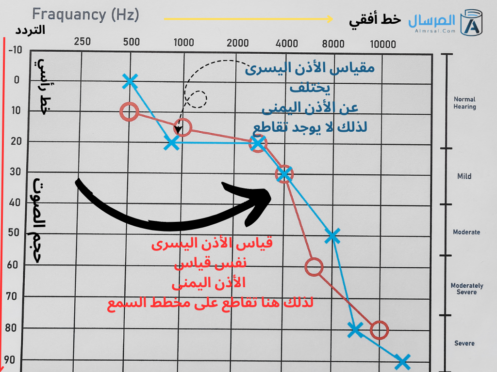 كيف اقرأ مخطط السمع