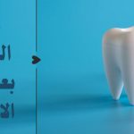 مدة الشفاء بعد خلع الاسنان: حتى يلتئم جرح الخلع