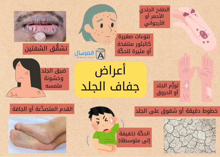 أعراض جفاف الجلد
