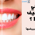 اسناني صفراء كيف ابيضها ؟ اسرع طريقة لتبييضها