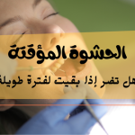 الحشوة المؤقتة هل تضر إذا بقيت لفترة طويلة