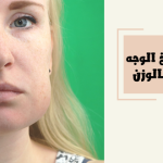 انتفاخ الوجه بدون زيادة بالوزن .. الأسباب