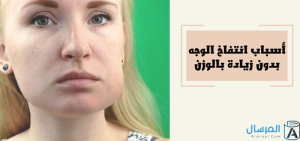 انتفاخ الوجه بدون زيادة بالوزن .. الأسباب