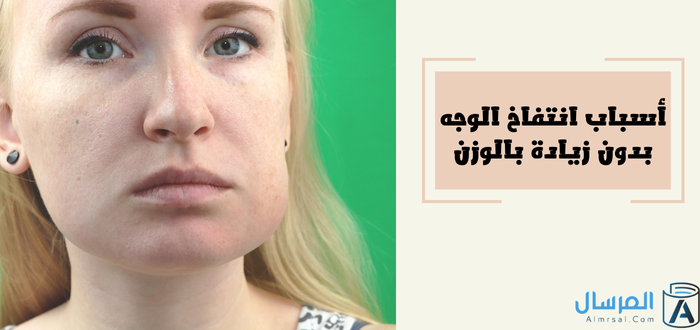 انتفاخ الوجه بدون زيادة بالوزن .. الأسباب