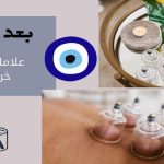 بعد الحجامة علامات تدل على خروج العين