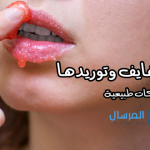 تقشير الشفايف وتوريدها ماسكات بخلطات طبيعية