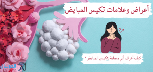 تكيس المبايض : كيف اعرف اذا عندي تكيسات او لا