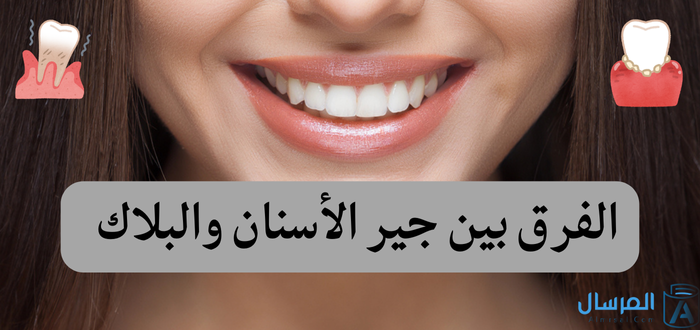 جير الاسنان: أنواعه .. والفرق بينه وبين البلاك