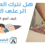 هل تترك الحجامه اثر على الجلد ؟ .. كيف أمنع اثرها