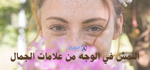 النمش في الوجه من علامات الجمال : صفات شخصيتهم