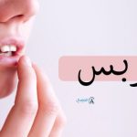 الهربس أنواع وأشكال من أين تأتي الإصابه بها