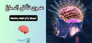 عدوى تآكل الدماغ أسبابها وأعراضها وعلاجها