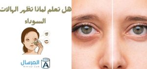هل تعلم لماذا تظهر الهالات السوداء
