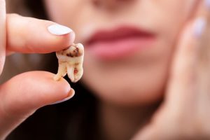 تسوس الاسنان تغير فيزيائي ام كيميائي