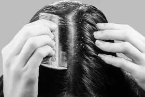 نزع القشرة من الشعر في المنام للعزباء التفسير والدلالات