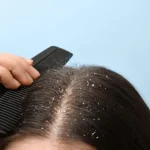 نزع القشرة من الشعر في المنام للمتزوجة التفسير الكامل