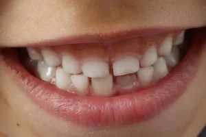 اختلاف شكل الاسنان وأهميته