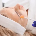 "مقارنة تقشير أحماض الفواكه والتقشير البارد" و"أنواع تقشير البشرة AHA BHA"
