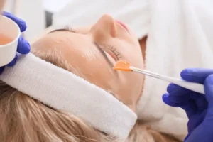 "مقارنة تقشير أحماض الفواكه والتقشير البارد" و"أنواع تقشير البشرة AHA BHA"